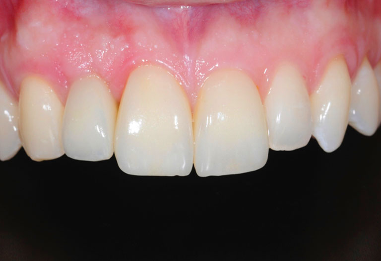chirurgie esthetique dents geneve