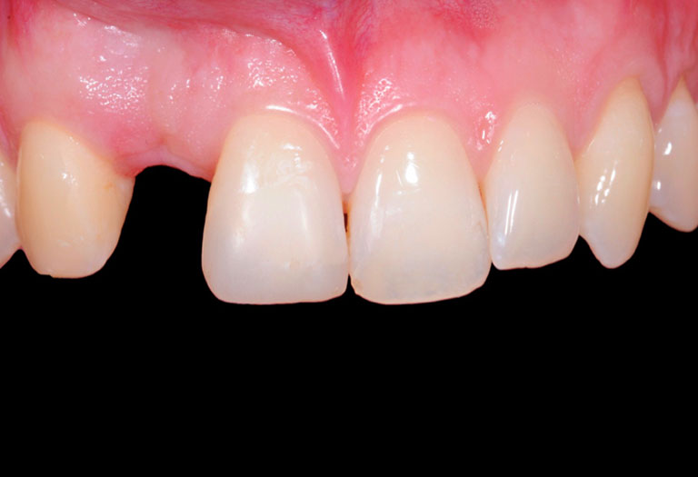 chirurgie des dents geneve chirurgie des dents geneve