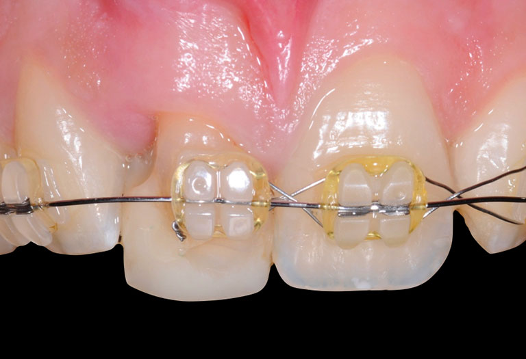 orthodonthie geneve
