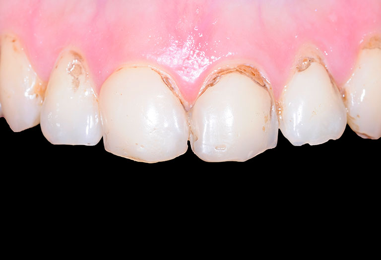 dentiste geneve suisse dentiste geneve suisse