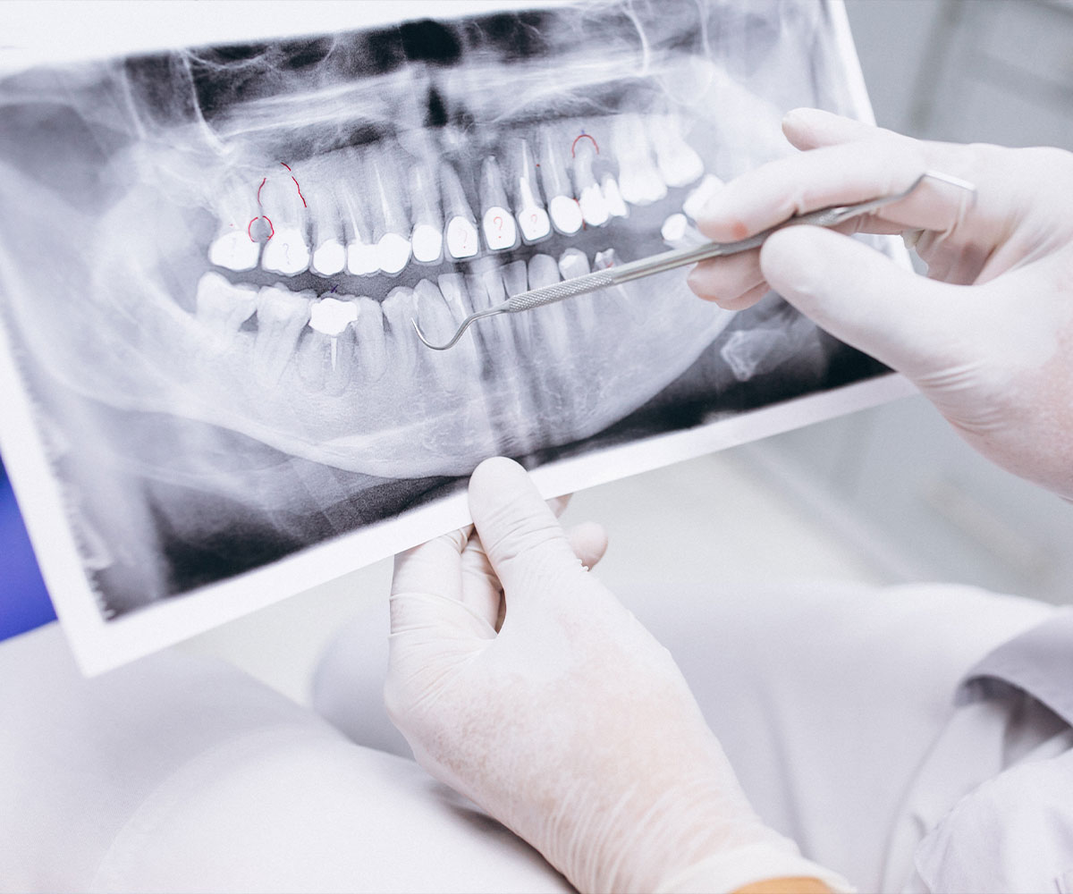 chirurgie des dents geneve