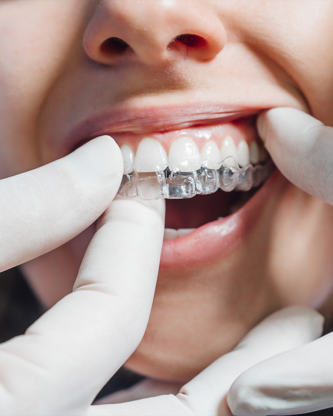 cabinet d orthodontie geneve cabinet d orthodontie geneve