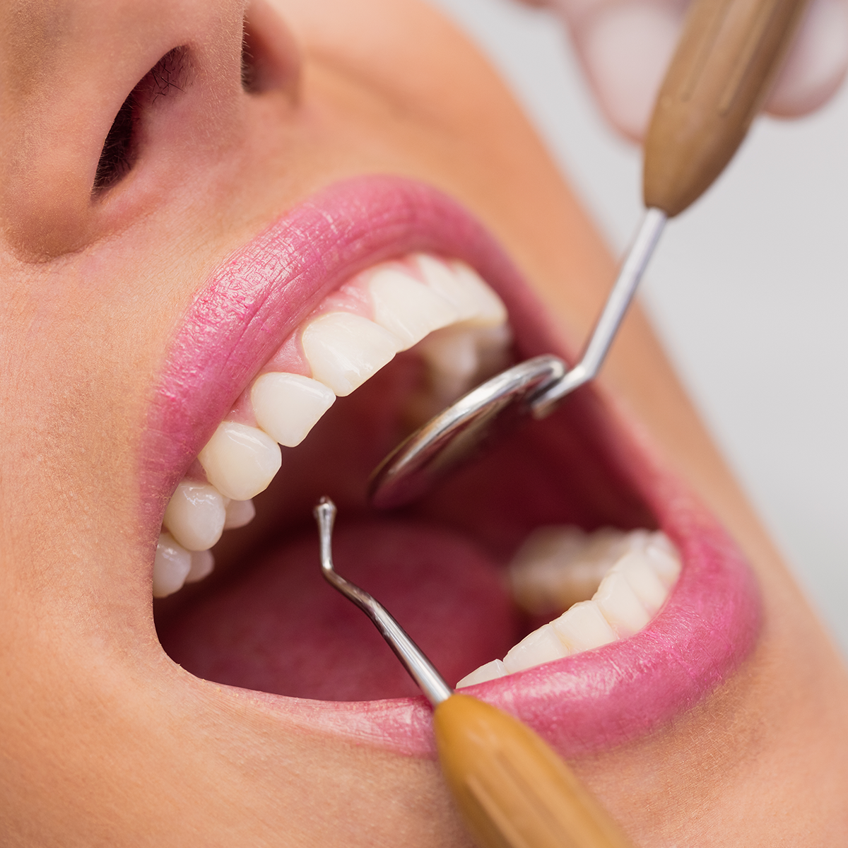 clinique chirurgie dentaire esthetique geneve clinique chirurgie dentaire esthetique geneve